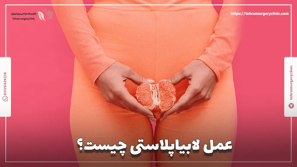 عمل لابیاپلاستی چیست؟