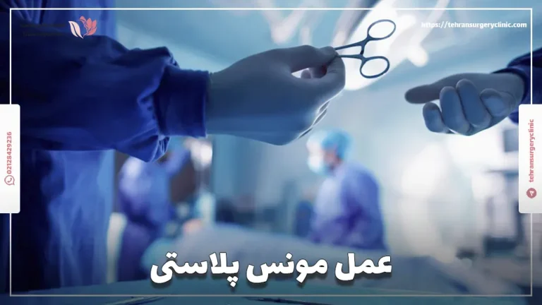 عمل مونس پلاستی: انواع و هزینه لیفت مونس پوبیس