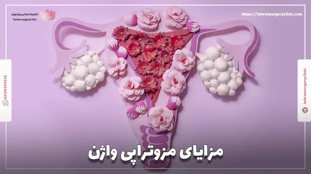 مزایای مزوتراپی واژن
