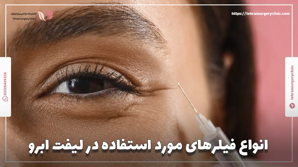 انواع فیلرهای مورد استفاده در لیفت ابرو