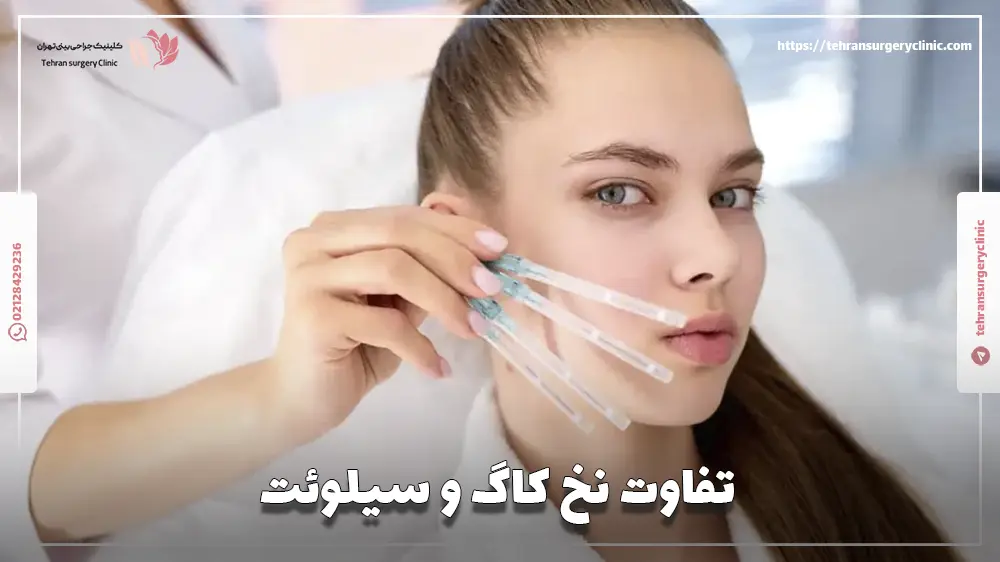 تفاوت نخ کاگ و سیلوئت