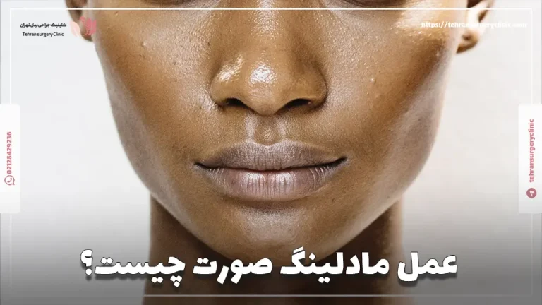 عمل مادلینگ صورت چیست؟ هزینه مادلینگ زاویه سازی صورت