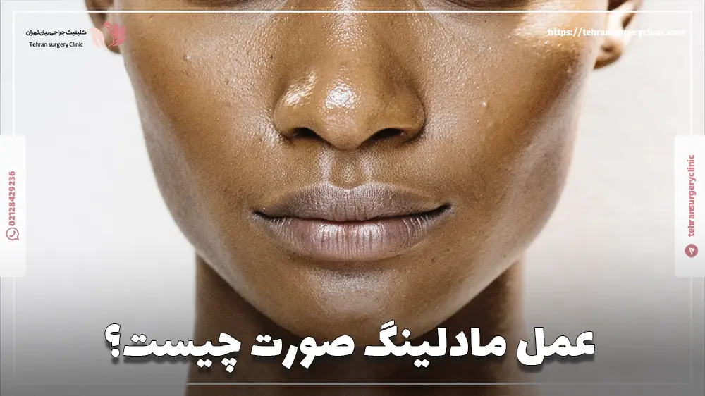 عمل مادلینگ صورت چیست