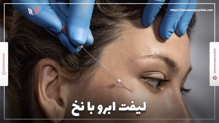 لیفت ابرو با نخ: ماندگاری و هزینه کشیدن ابرو با نخ