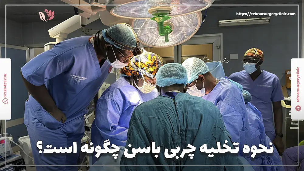 نحوه تخلیه چربی باسن چگونه است؟