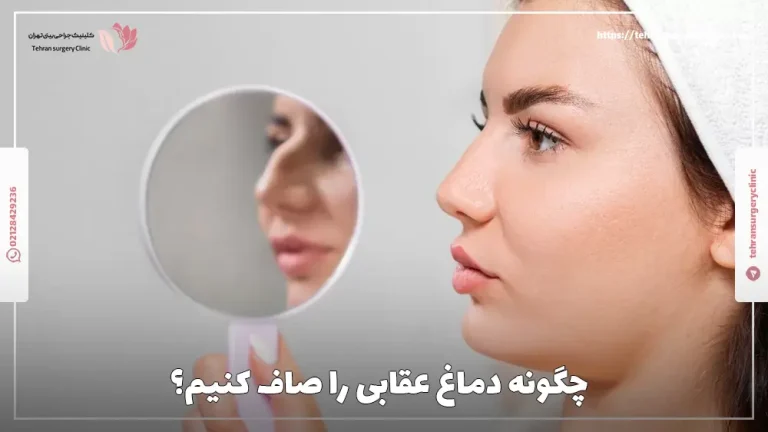 چگونه دماغ عقابی را صاف کنیم؟ | 6 روش صاف کردن بینی عقابی