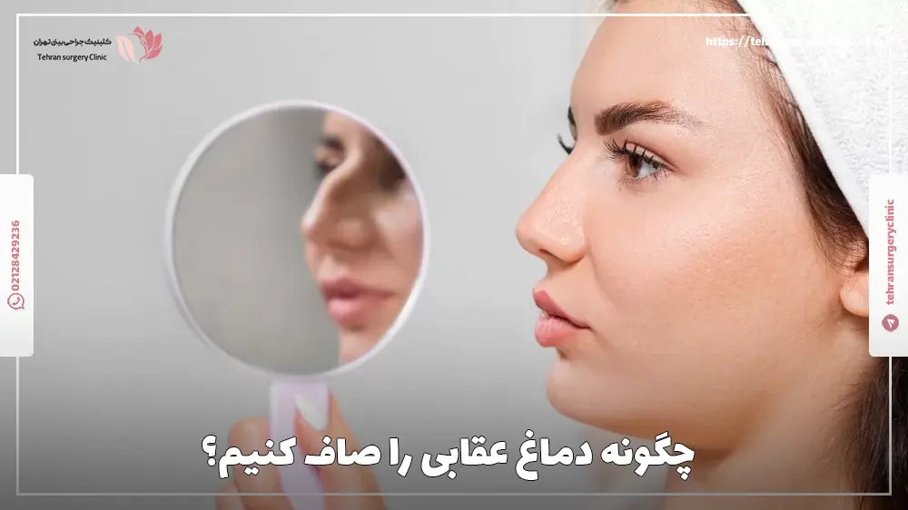 چگونه دماغ عقابی را صاف کنیم؟