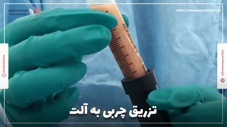 تزریق چربی به آلت: کاندید و هزینه بزرگ کردن آلت با چربی
