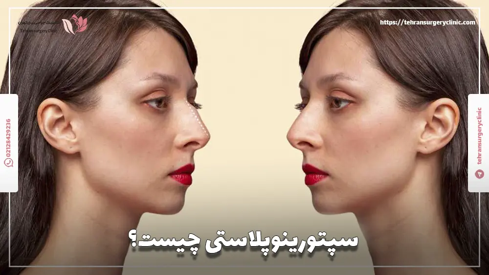 سپتورینوپلاستی چیست؟