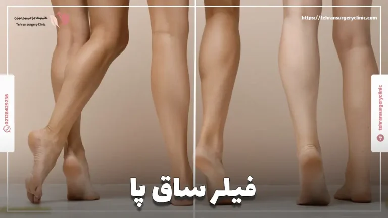فیلر ساق پا | کاندید، ماندگاری و هزینه فیلر ساق پا
