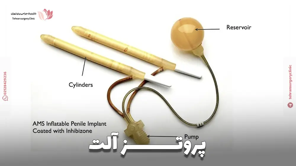 پروتز آلت