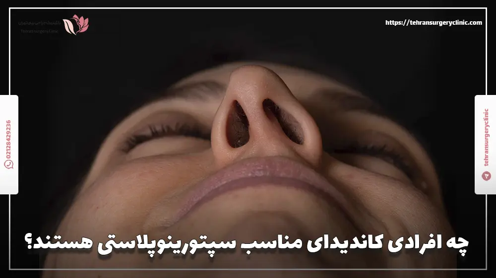 چه افرادی کاندیدای مناسب سپتورینوپلاستی هستند؟