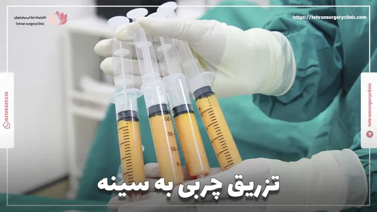 تزریق چربی به سینه: نحوه، عوارض و هزینه تزریق چربی سینه