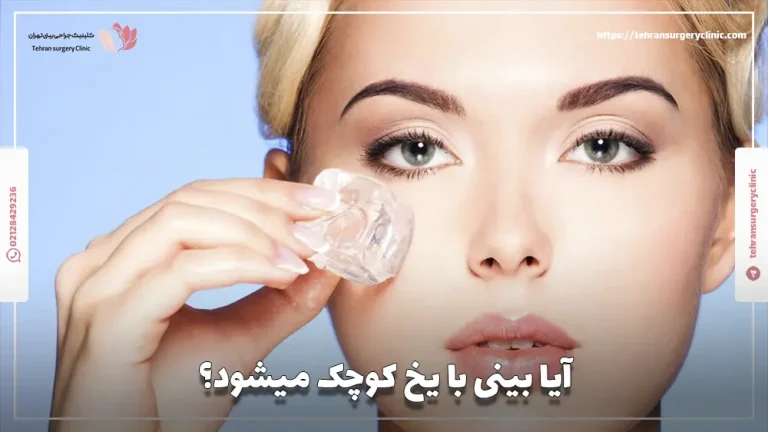 آیا بینی با یخ کوچک میشود؟ افسانه یا واقعیت؟
