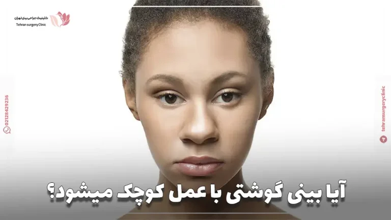 آیا بینی گوشتی با عمل کوچک میشود؟