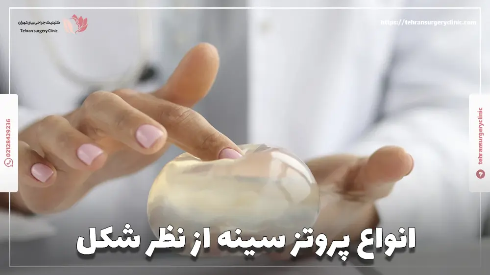 انواع پروتز سینه از نظر شکل