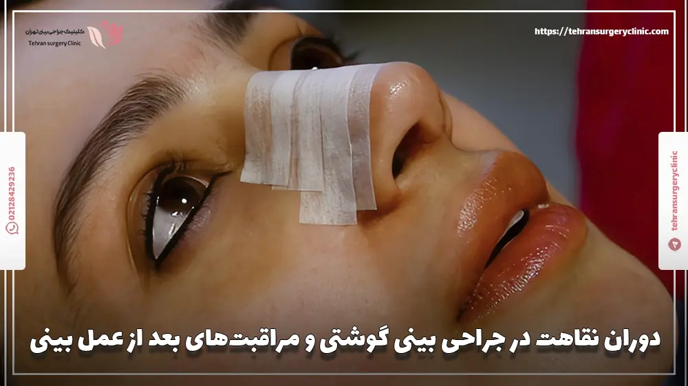 دوران نقاهت در جراحی بینی گوشتی و مراقبت‌های بعد از عمل بینی