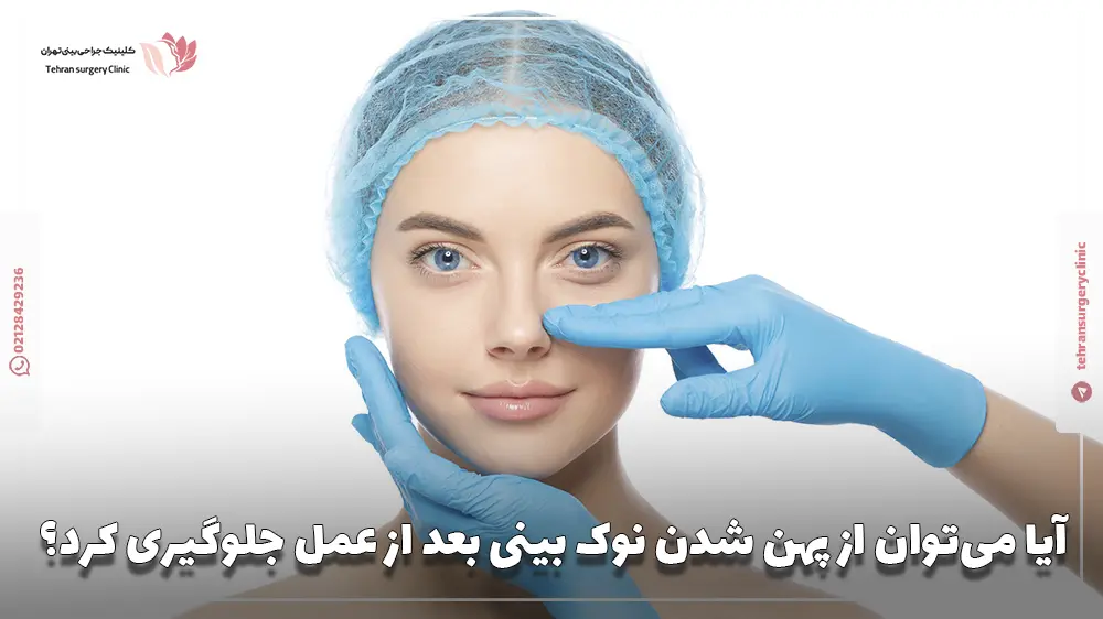 آیا می‌توان از پهن شدن نوک بینی بعد از عمل جلوگیری کرد؟