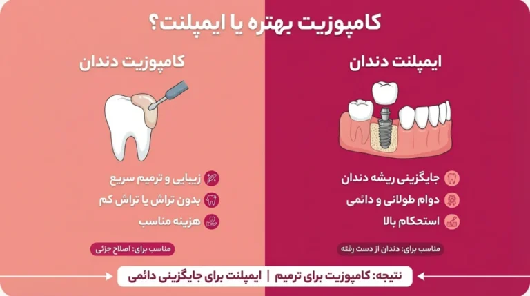 کامپوزیت بهتره یا ایملپنت؟ مقایسه ایمپلنت دندان با کامپوزیت