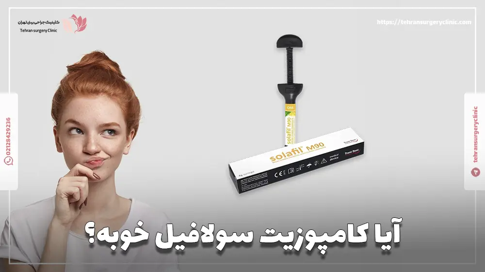 آیا کامپوزیت سولافیل خوبه؟
