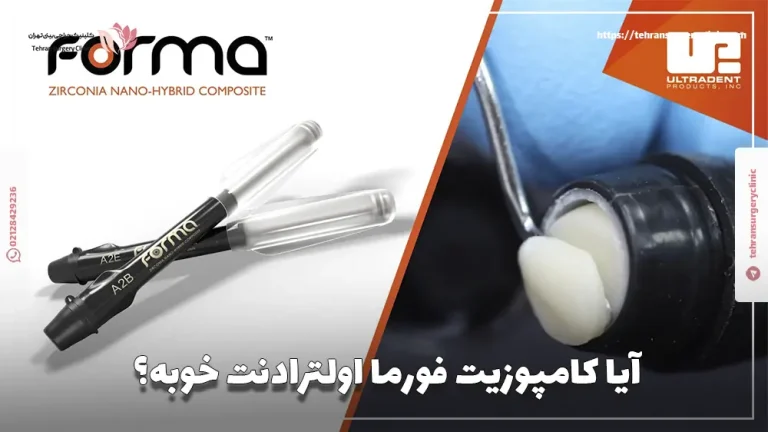 کامپوزیت فورما (Forma): آیا کامپوزیت فورما اولترادنت خوبه؟