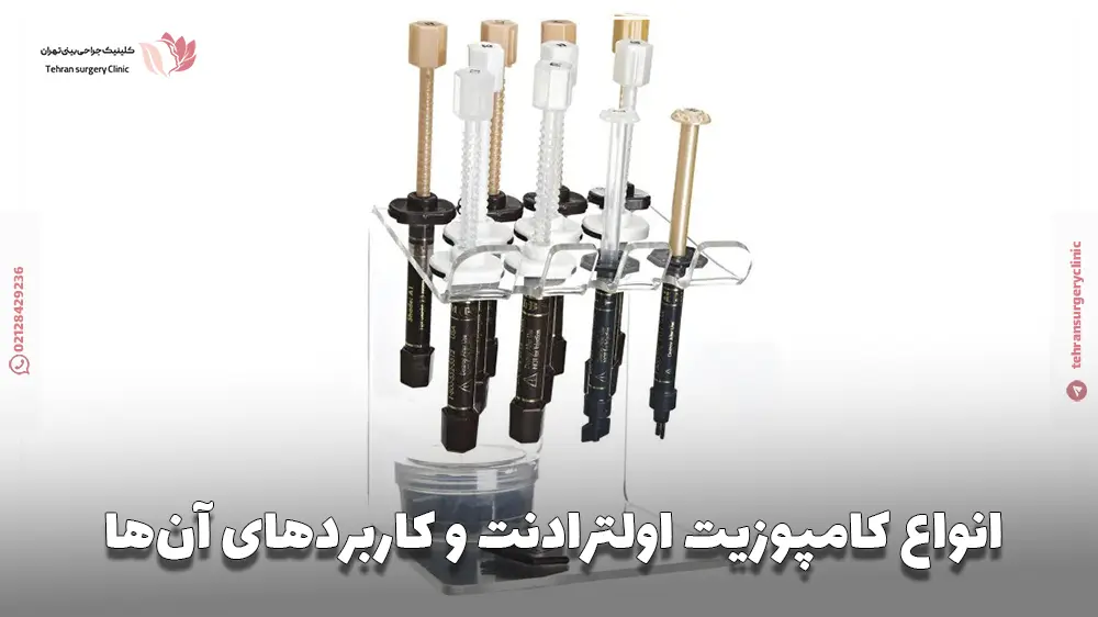 انواع کامپوزیت اولترادنت و کاربردهای آن‌ها