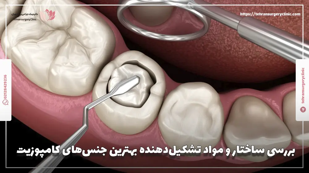 بررسی ساختار و مواد تشکیل‌دهنده بهترین جنس‌های کامپوزیت