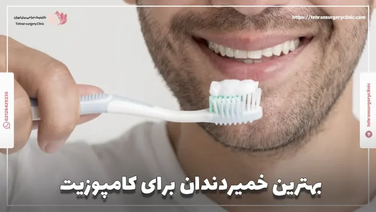 بهترین خمیردندان برای کامپوزیت: 4 برند خمیر دندان کامپوزیت