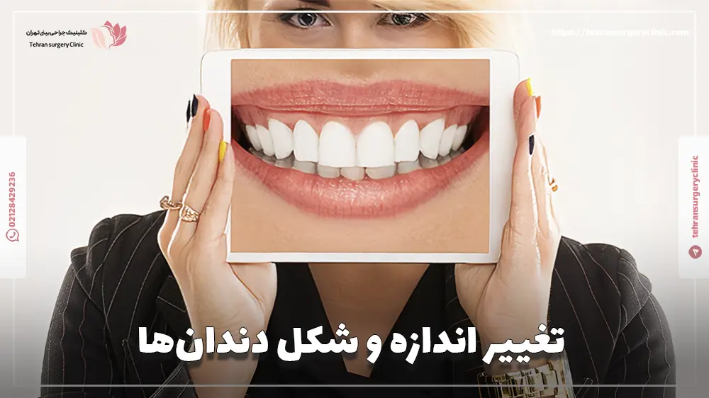 تغییر اندازه و شکل دندان‌ها