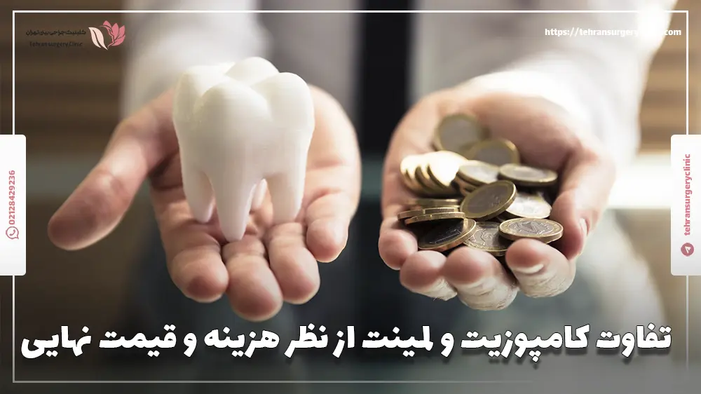 تفاوت کامپوزیت و لمینت از نظر هزینه‌ و قیمت نهایی