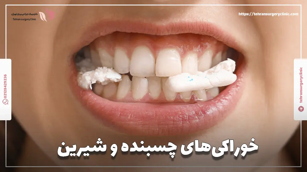 خوراکی‌های چسبنده و شیرین