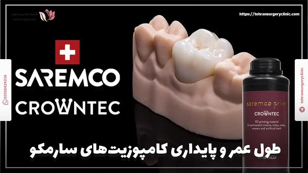 طول عمر و پایداری کامپوزیت‌های سارمکو