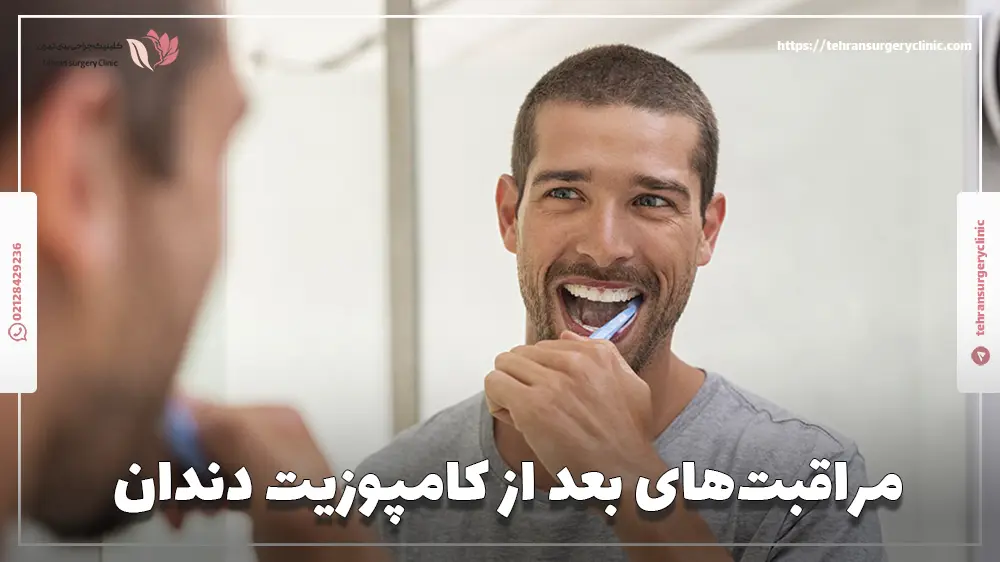 مراقبت‌های بعد از کامپوزیت دندان