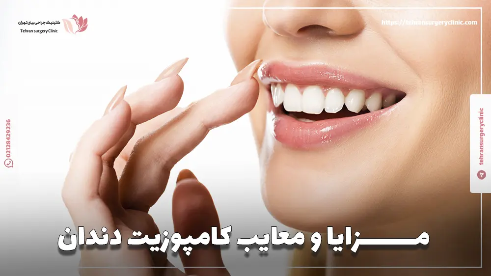 مزایا و معایب کامپوزیت دندان