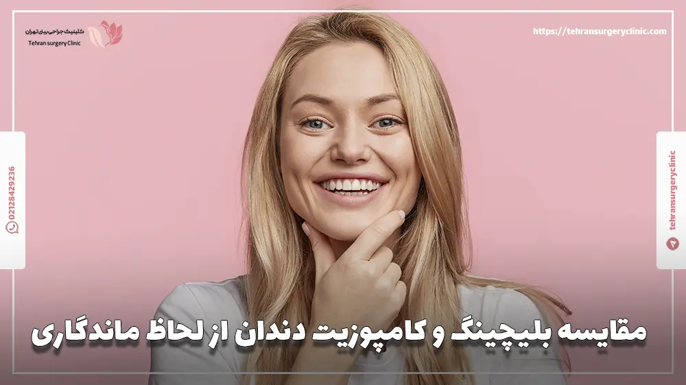 مقایسه بلیچینگ و کامپوزیت دندان از لحاظ ماندگاری