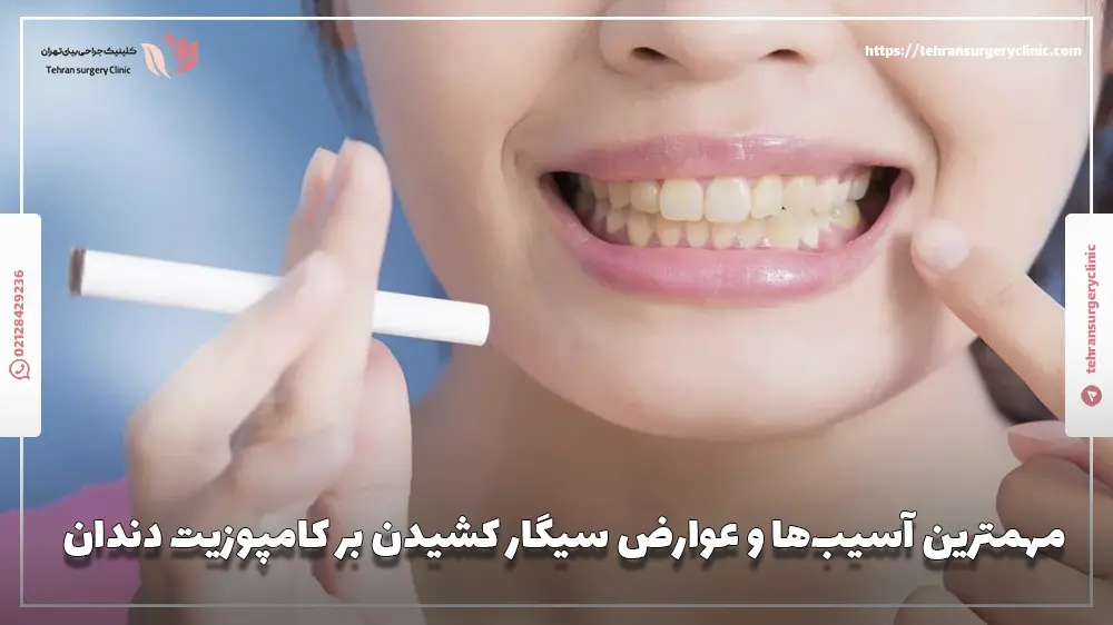 مهمترین آسیب‌ها و عوارض سیگار کشیدن بر کامپوزیت دندان