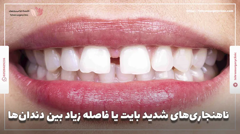 ناهنجاری‌های شدید بایت یا فاصله زیاد بین دندان‌ها
