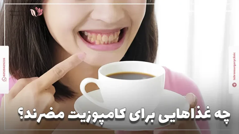 چه غذاهایی برای کامپوزیت مضرند؟ 8 غذای ممنوعه کامپوزیت