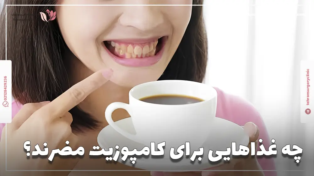 چه غذاهایی برای کامپوزیت مضرند؟