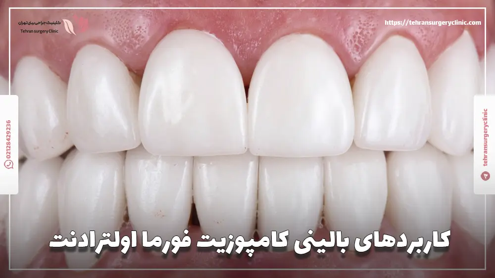 کاربردهای بالینی کامپوزیت فورما اولترادنت
