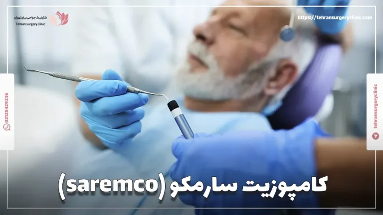 کامپوزیت سارمکو (saremco): انواع و طول عمر کامپوزیت سارمکو