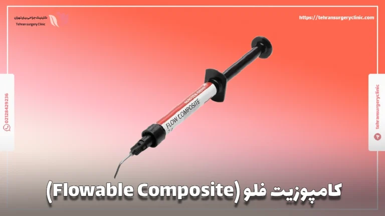 کامپوزیت فلو (Flowable Composite): ویژگی‌ها و مزایا