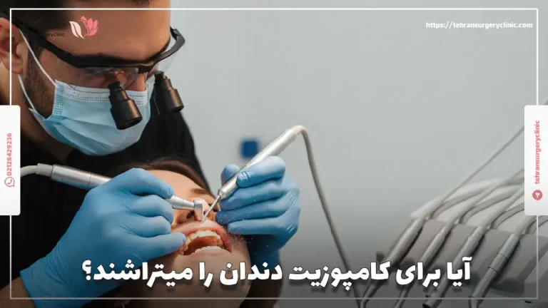 آیا برای کامپوزیت دندان را میتراشند؟