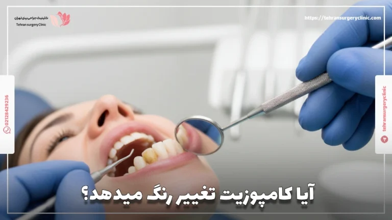 آیا کامپوزیت تغییر رنگ می‌ دهد: علت تغییر رنگ کامپوزیت دندان