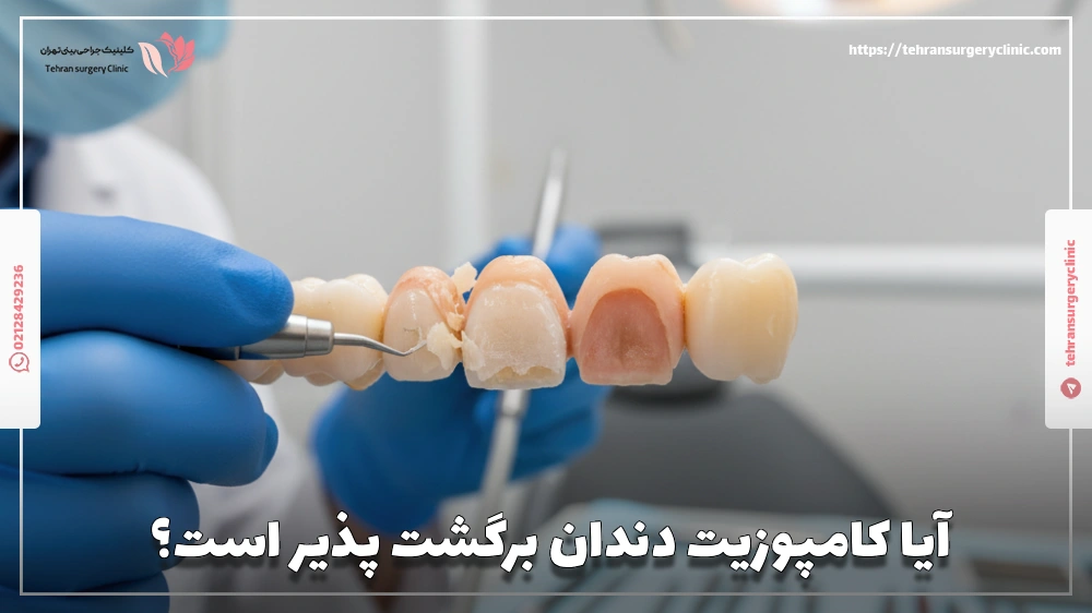 آیا کامپوزیت برگشت‌ پذیر است