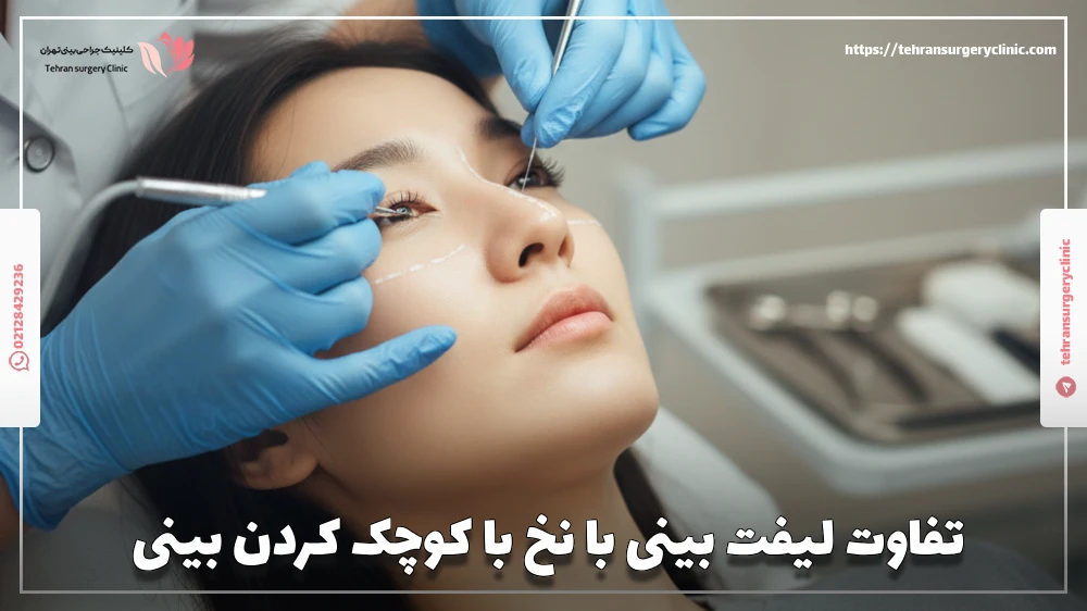 تفاوت لیفت بینی با نخ با کوچک کردن بینی