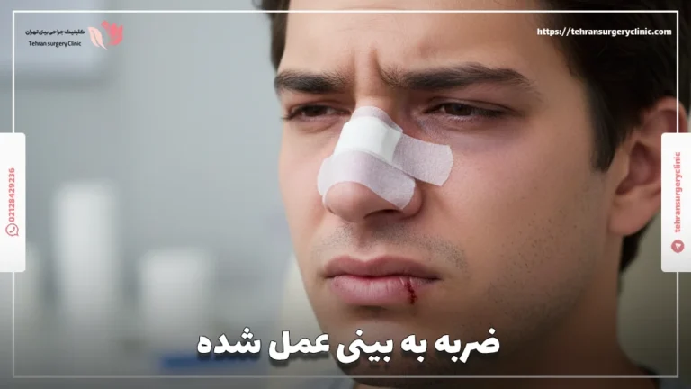 ضربه به بینی عمل شده: خطرات و عوارض ضربه به دماغ عمل شده