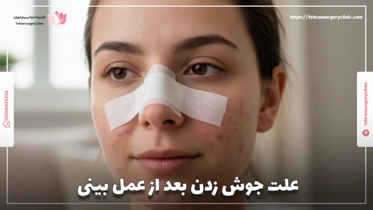 جوش بعد از عمل بینی: علت ایجاد جوش داخل و روی بینی