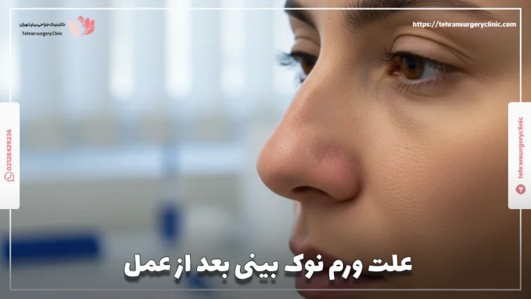 علت ورم نوک بینی بعد از عمل: ورم نوک بینی کی میخوابه؟