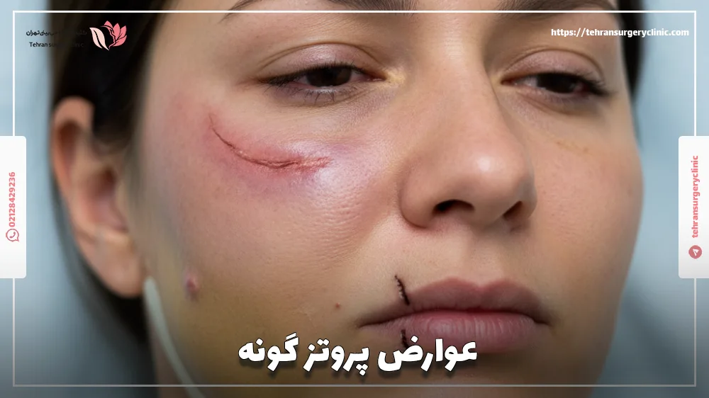 عوارض پروتز گونه